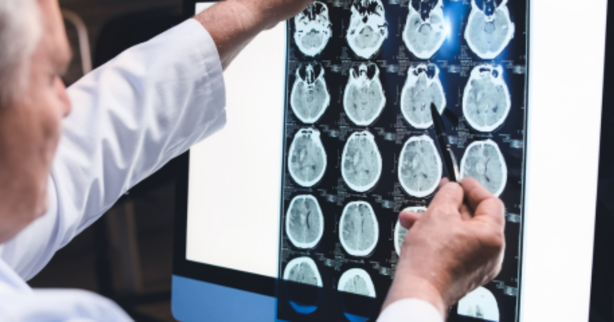 Head Disability Denied Disability for Head Trauma - Share Lawyers